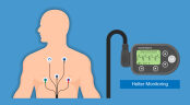 هولتر مانیتورینگ قلب هولتر نوار قلب ECG holter